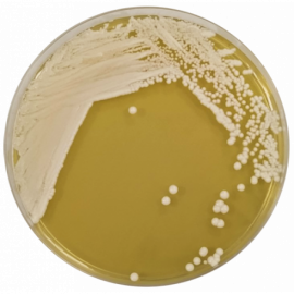 Agar Yeast Mold