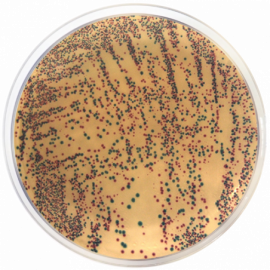 Agar Cromogénico E. coli-Enterobacteria
