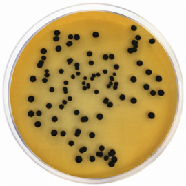 Agar Salmonella Shigella (Agar SS)