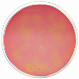 Agar DCLS (Desoxicolato, Citrato, Lactosa, Sacarosa)