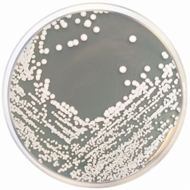 Agar Micobiótico (Agar Selectivo para Hongos)