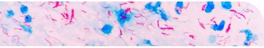 Colorantes y tinciones para la microbiología clínica