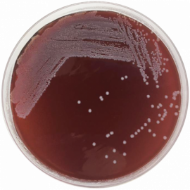 Tryptose Blood Agar Base