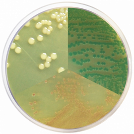 Vibrio Chromogenic Agar