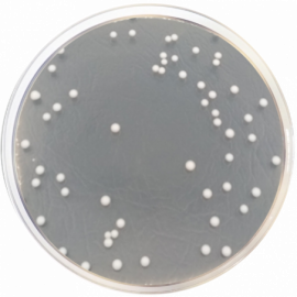 Agar Dextrosa Sabouraud con Cloranfenicol y Gentamicina