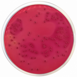 Desoxycholate Lactose Agar