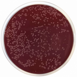 Campylobacter Agar Base (Preston)