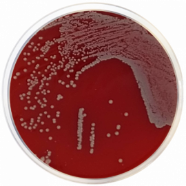 TSA Agar Nº2 Modified