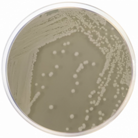 Medio OGA (Base de Agar Glucosa Oxitetraciclina) (OGYE)