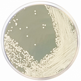 Glucose Chloramphenicol Agar