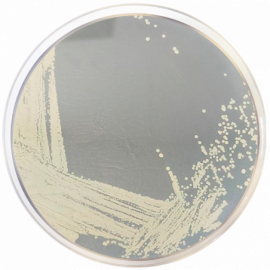 Agar Test DNAsa (Actividad Desoxirribonucleasa)