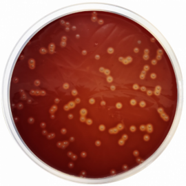 Brain Heart Infusion Agar (BHI Agar)