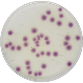 Standard Method Chromogenic Agar (PCA)