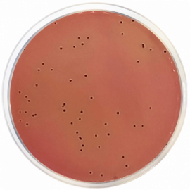 Modified Salmonella Shigella Agar