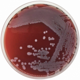 Blood Agar Base