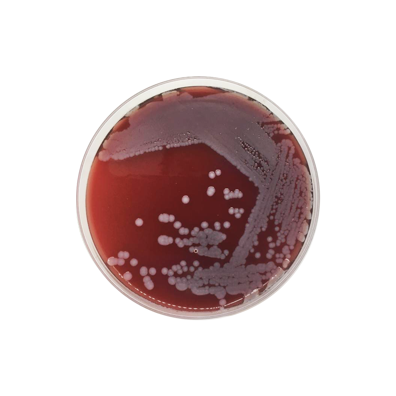 Base de Agar Sangre Formato 500 g