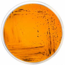 Deoxycholate Citrate Agar