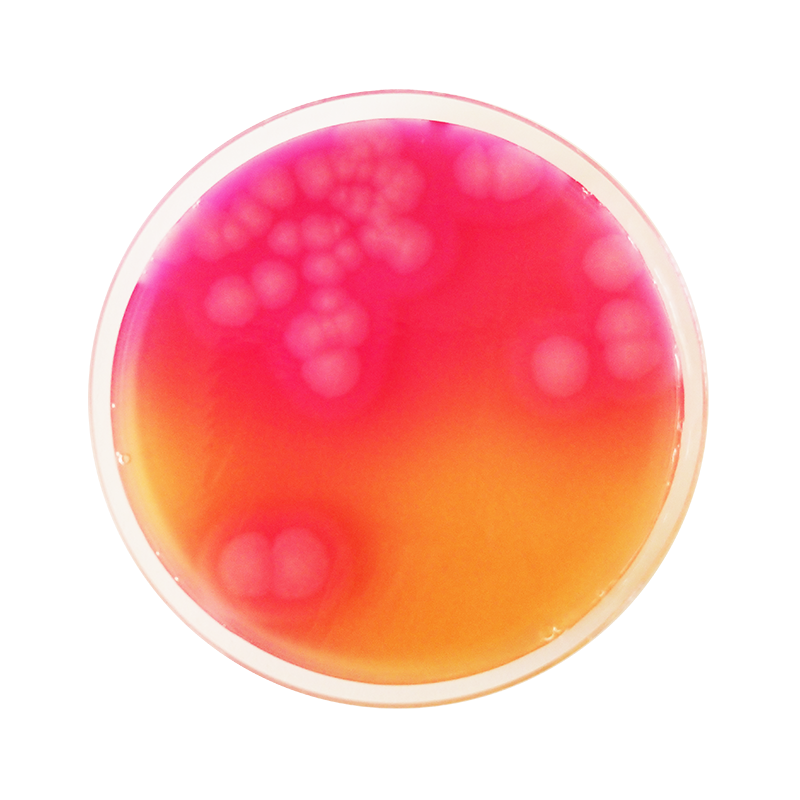 Ба агар. Агар для Бациллюс цереус. Bacillus Cereus на MYP. B Cereus микробиология. Bacillus Cereus Ожешко.