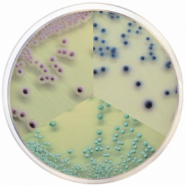 Candida Chromogenic Agar