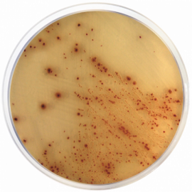 E. coli O157:H7 Cromogenic Agar Base