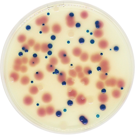 Urinary Tract Infections Chromogenic Agar (UTIC)