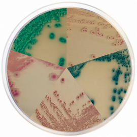 Candida Chromogenic Agar