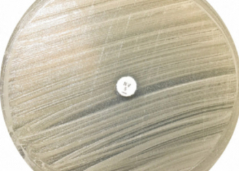 Antimicrobial resistance, the next global public health challenge?