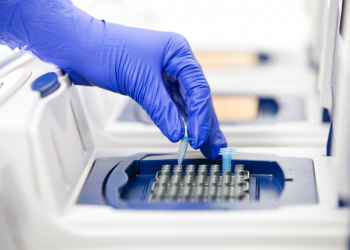 qPCR vs traditional microbiology techniques, which wins?