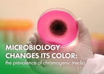 Microbiology changes its color: the prevalence of chromogenic media