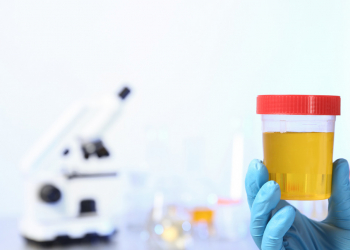 CondaChrome® para el diagnóstico rápido de uropatógenos