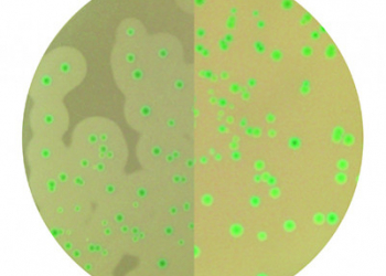 En caso de duda, CondaChrome Listeria®