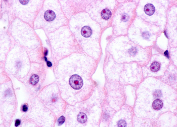 Webinar: hepatocitos derivados de hiPSC para terapia celular 