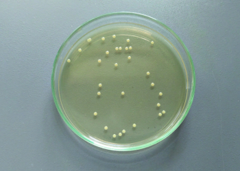 ¿Empleas habitualmente bacterias competentes? 