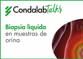 Webinar 14 de Junio: Biopsia líquida en muestras de orina