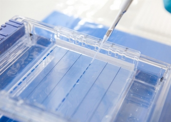 ¿Problemas con el procesado de muestras tras la electroforesis? 